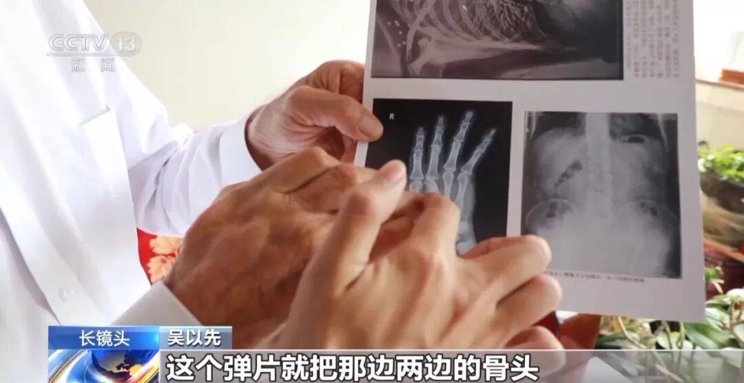 皇冠信用怎么弄
_“老先生皇冠信用怎么弄
，您把项链取下来再做CT”“你看是不是弹片”