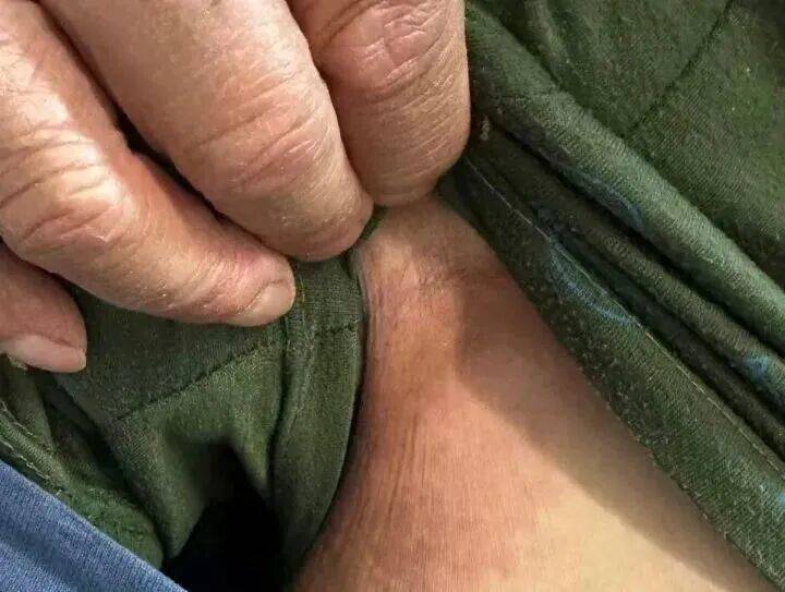 皇冠信用需要押金吗
_68岁大伯被蚂蚁围攻送进抢救室!短短十几秒爬满全身皇冠信用需要押金吗
,罪魁祸首竟是院子里的“宝贝”