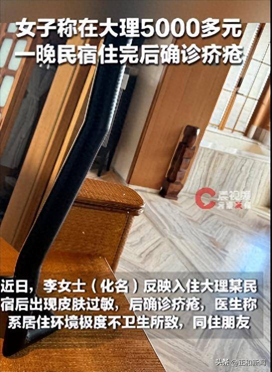 皇冠体育App下载_女子称在大理住5000多元一晚的民宿后过敏一个月确诊疥疮皇冠体育App下载，沟通维权却被回复“如果需要不投诉以及不发帖，要给多少钱”，目前民宿拒绝采访
